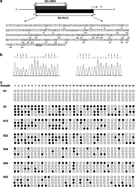 Methylation status of the CpG island region in the deleted in liver... | Download Scientific Diagram