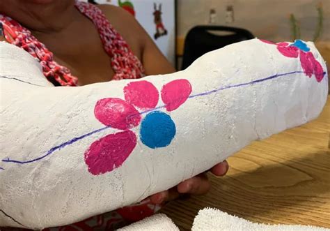 How to paint and decorate an arm cast - Crafty Chica