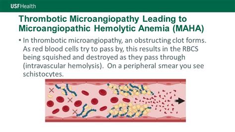 MAHA, TTP, HUS, DIC... Oh My! Understanding Microangiopathic Hemolytic ...