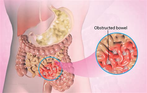 Health Condition : Symptoms, Causes, Treatment and More