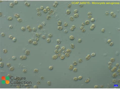 Microcystis aeruginosa