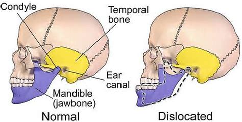 Treating Jaw Disorders - Harley Street Maxillofacial Clinic