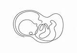 Sketch Of A Baby In The Womb Coloring Pages sketch template