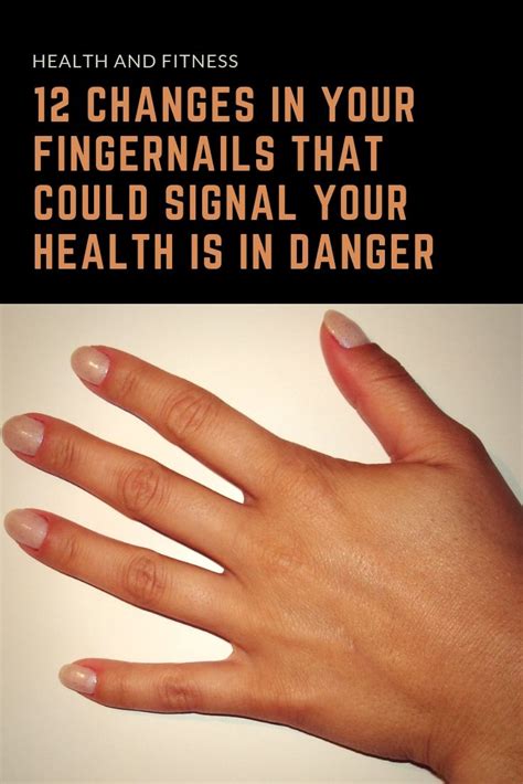 15 Health Warning Signs from Your Fingernails | Fingernail health signs ...