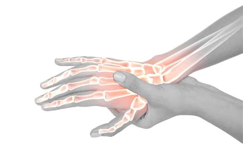 Is My Wrist Broken or Sprained? - Injury Health Blog