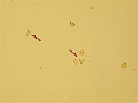 Renal Tubular Epithelial