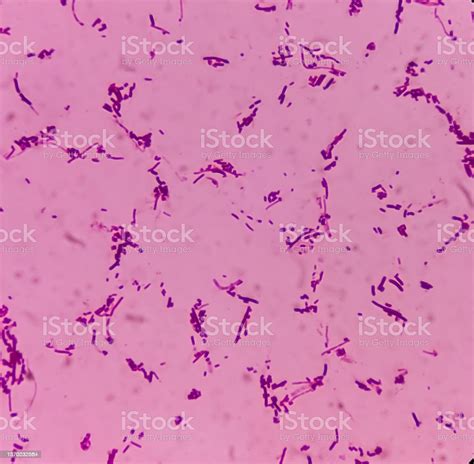 Salmonellosis Microscopic View Of Gram Stained Slide From Blood Agar Salmonella Colonies Show ...