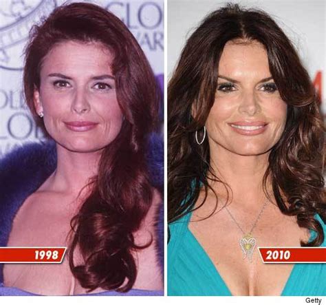 Roma Downey Plastic Surgery Before And After Photos - CelebLens.Com