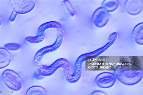 Brugia Malayi Parasitic Worm Illustration High-Res Vector Graphic ...