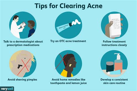 10 Smart Ways to Treat Teen Acne in Boys