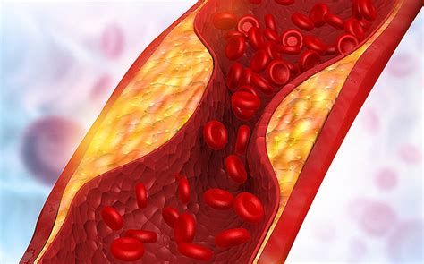 6 Ways to Lower Triglycerides for a Healthy Heart- HealthXchange.sg