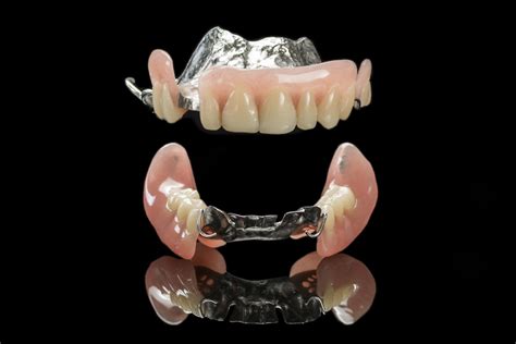 Edentulism: Finding the Perfect Fit with Partial Dentures