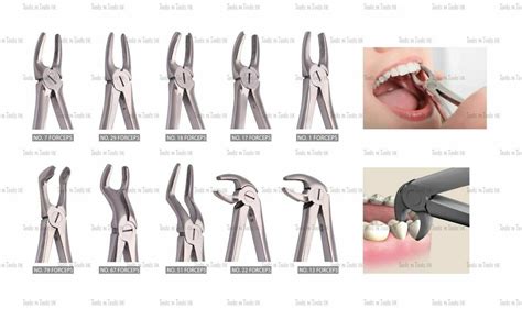 10 DIFFERENT EXTRACTING FORCEPS DENTAL INSTRUMENTS TOOTH SURGERY S STEEL CE MARK - Tools N Tools UK