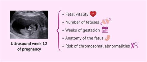 12-week ultrasound scan