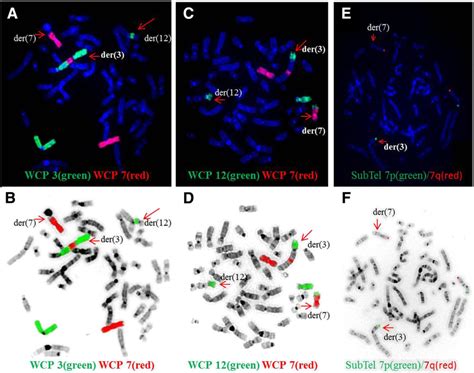 FISH results with whole-chromosome painting (WCP) for chromosomes 3 and... | Download Scientific ...