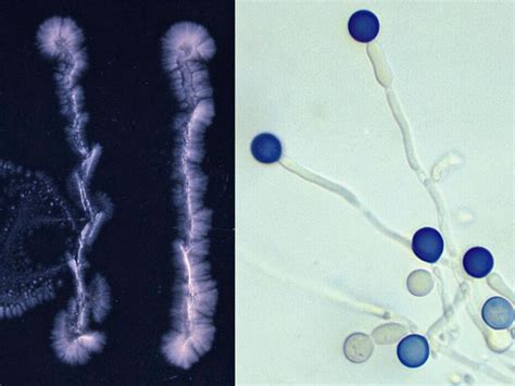 Yeast-like Fungi | Mycology | University of Adelaide