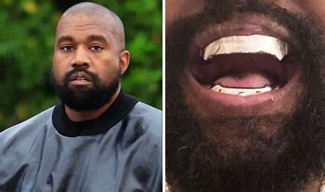 Kanye West has Bond villain transformation with metal teeth that cost 'more than diamonds ...