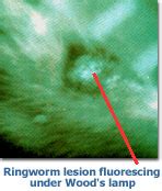 Ringworm: The Fluorescent Fungi - FixNation