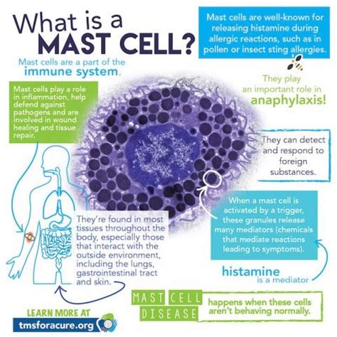 Great printable infographics on mast cell disease | alvinalexander.com