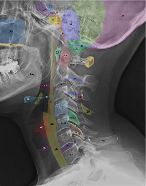 Training Mode Enabled | Ortopedia y traumatologia, Radiología, Imagenologia