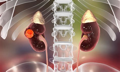 Kidney cancer treatment resistance and mitochondrial content in cells