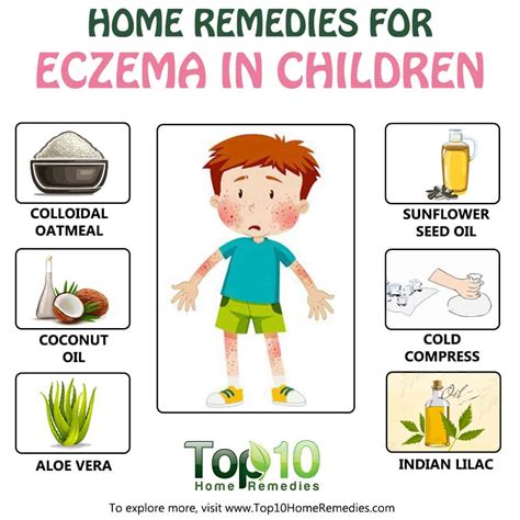 Home Remedies for Eczema in Children | Top 10 Home Remedies