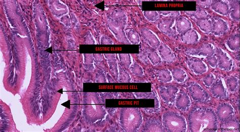 stomach-1-slide-labelled-histology | Online Homework Help | SchoolWorkHelper