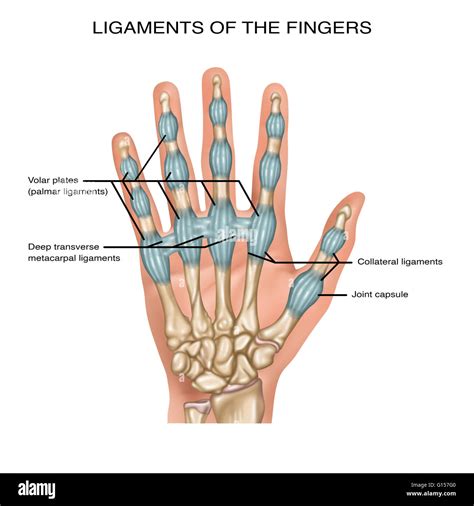 Illustration showing ligaments of the fingers. Noted are the volar plates (palmar ligaments ...