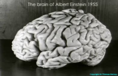 Brain of Albert Einstein - Wikipedia