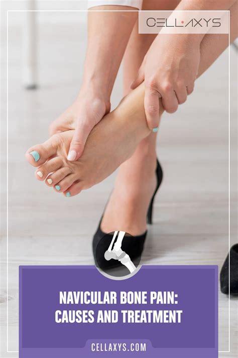 Navicular bone pain causes and treatment – Artofit