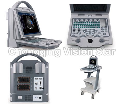 China UCD12 Portable Laptop Color Doppler Ultrasound Machine Best Price ...