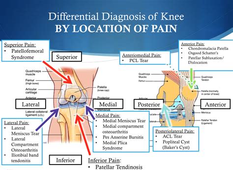 Anterior Knee Pain Scale