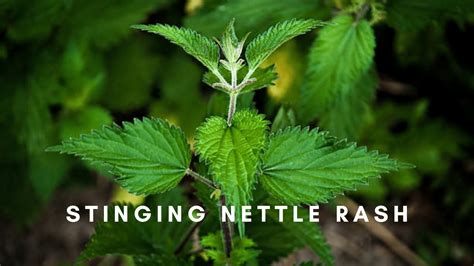 Stinging Nettle Rash - Symptoms, Risks And Treatment | SLECK