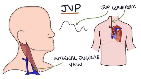 JUGULAR VENOUS PRESSURE - DR.RAJESH GUBBA - YouTube