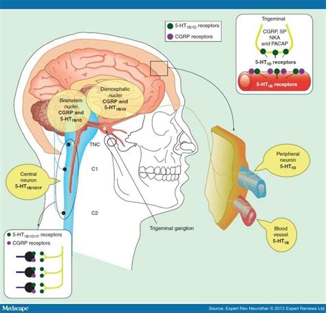 Hemicrania continua : Causes, Symptoms & Treatments | Global Treatment ...