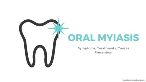 Oral Myiasis: Symptoms, Causes, Treatment, Prevention | BioWellBeing