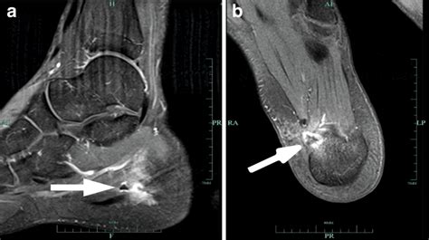 T1-weighted MRI. a Sagittal view. b Horizontal view. Figures show a... | Download Scientific Diagram