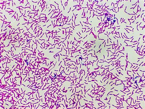 Premium Photo | Microscopic view of gram stain showing rod shape ...