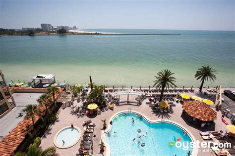 Holiday Inn Hotel & Suites Clearwater Beach Review: What To REALLY Expect If You Stay