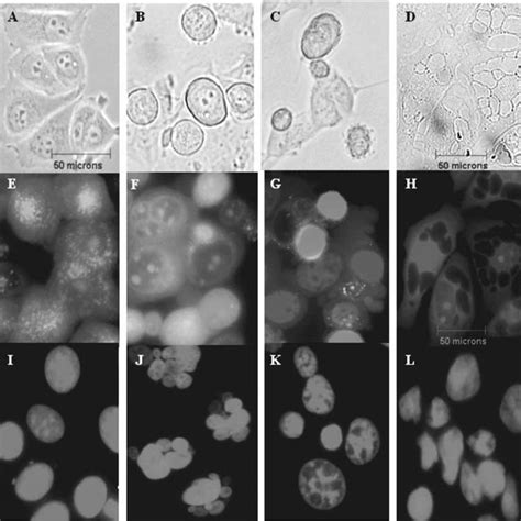 Flow cytometric assessment of untreated MCF-7 cells (A) and MCF-7 cells ...