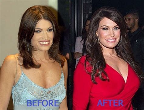 Kimberly Guilfoyle Plastic Surgery Rumors – Before and After Pictures Comparison | Glamour Path