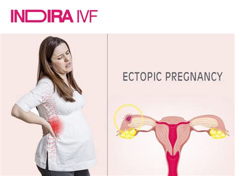 Ectopic Pregnnacy Treatment - Ectopic Pregnancy surgery by Niharika ...