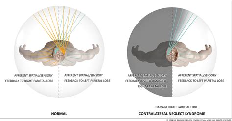 Sympathetic Nervous System Diagram