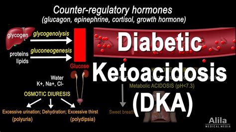 Diabetic Ketoacidosis (DKA) Pathophysiology, Animation - Diabetes