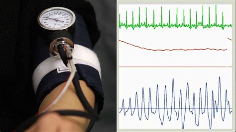 Oscillometric blood pressure measurement - YouTube