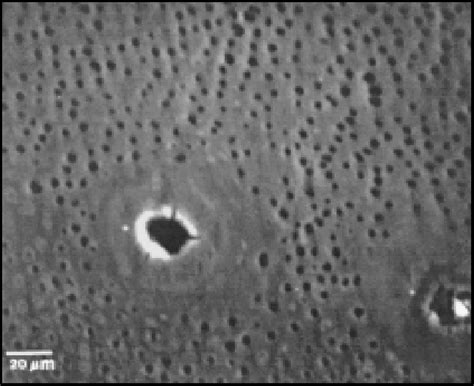 Figure 1 from Microstructure of primary tooth dentin. | Semantic Scholar