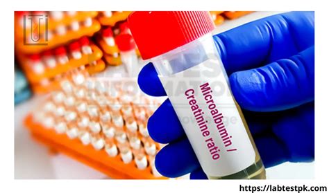 Albumin Creatinine Ratio