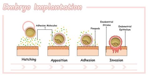 Premium Vector | Embryo Implantation