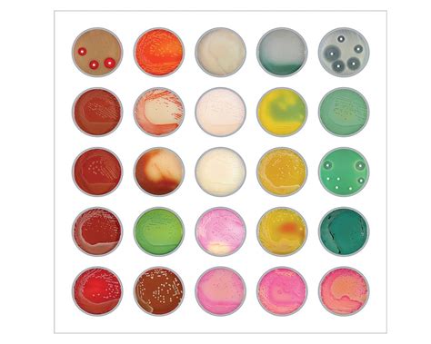 Bacteria Agar Plates II - Etsy