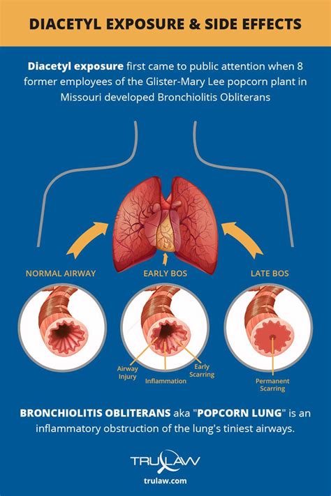 Bronchiolitis Obliterans (Popcorn Lung Disease) - Diacetyl Exposure | Popcorn plant, Lunges ...